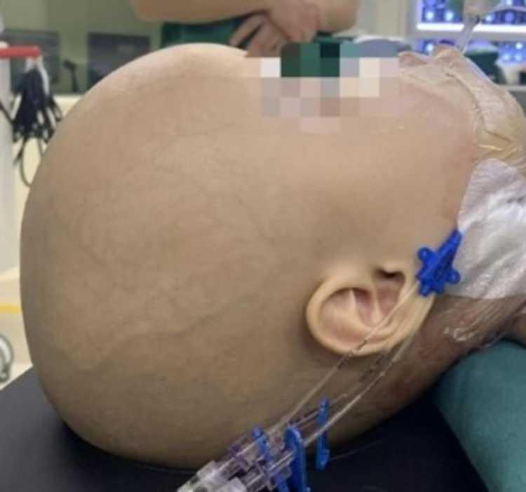 Durumun Belirtileri ve Aile'nin Endişeleri