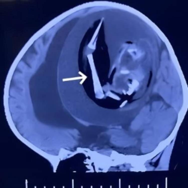 Sonuç ve Gelecek Perspektifi